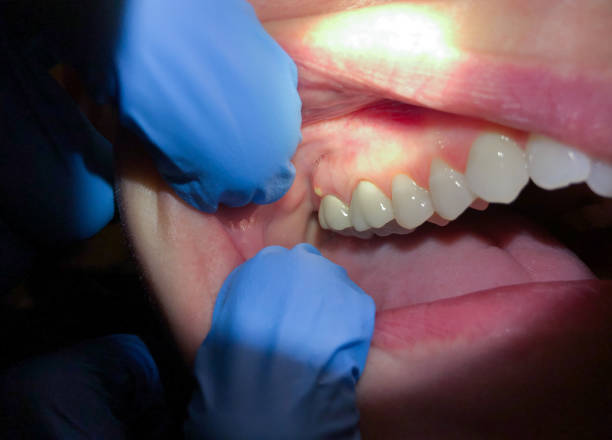 Best Urgent Care for Lost Fillings or Crowns in West Park, NJ
